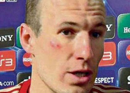 Pugno a Robben: multato Ribery