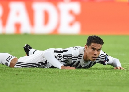 Juventus: 3 settimane di stop per Hernanes
