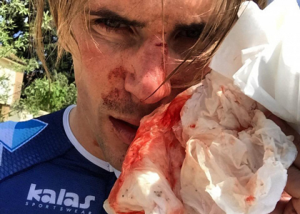 Ciclismo: Offredo aggredito e pestato